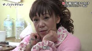 星愛美　日本最高齢ストリッパー
肺がんステージと生存率　現在の体調　病歴　子宮頸がん